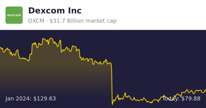 Dxcm stock price